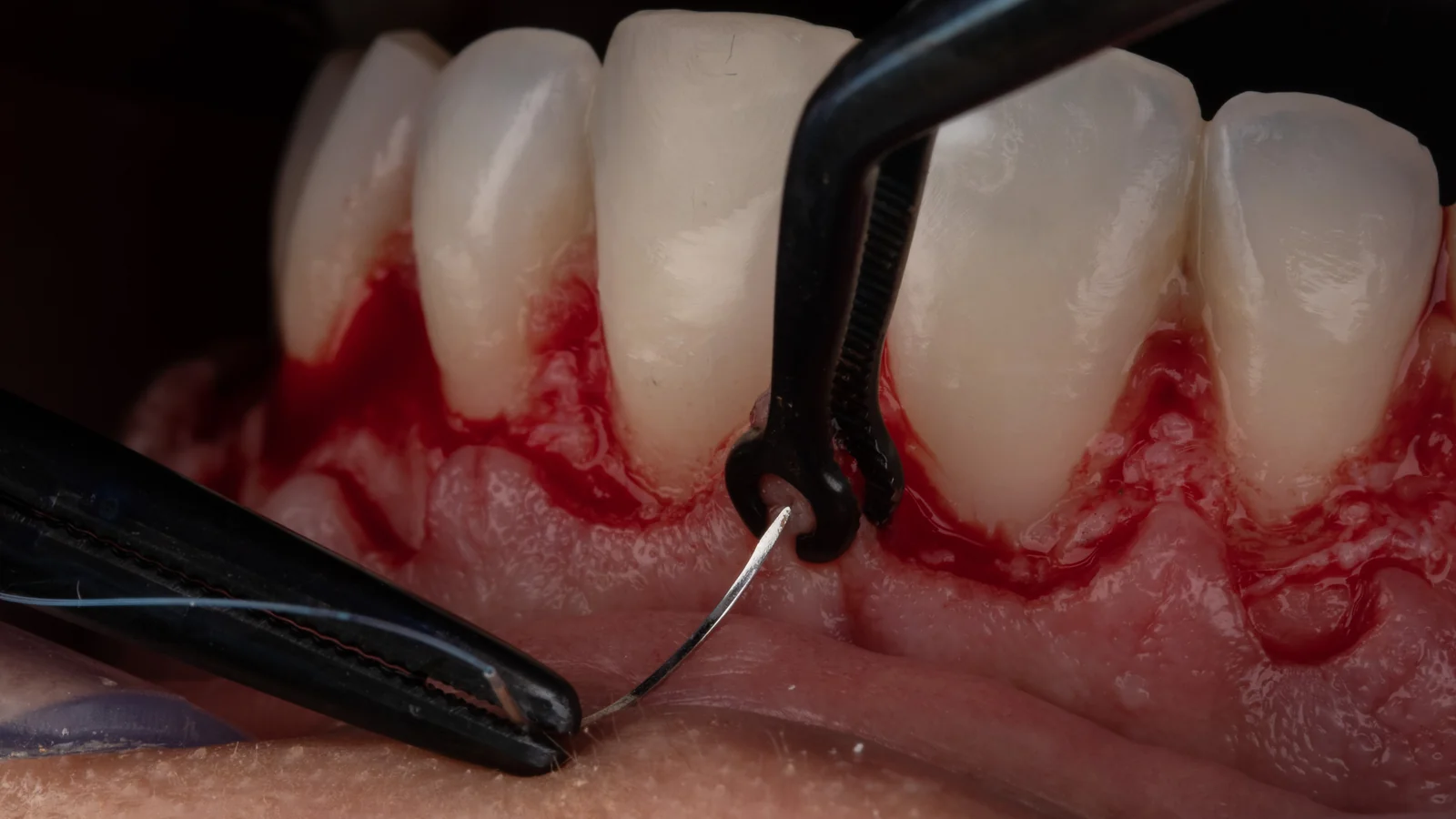 Planejamento e Proporção Dental Estética